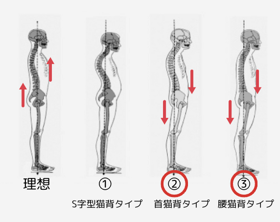 猫背改善エクササイズ【首猫背タイプ・腰猫背タイプ】 | 月島・勝どき・佃にあるパーソナルジム|YUMO(ユーモ)